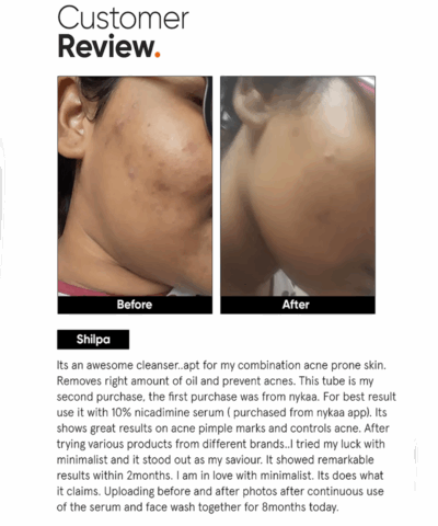 Salicylic Cleanser 5