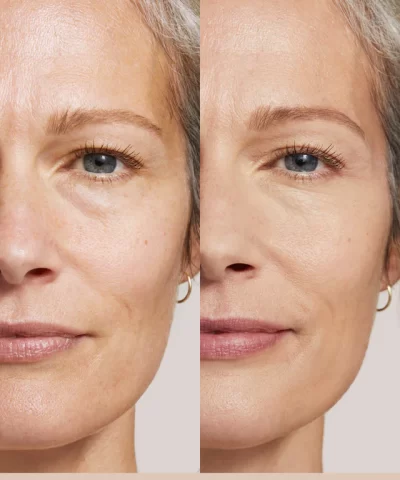 ILIA TSSC BEFORE AFTER 1200X1600 SC1 0eaa2f90 3f2c 4d89 8e51 edc2a779e5b8
